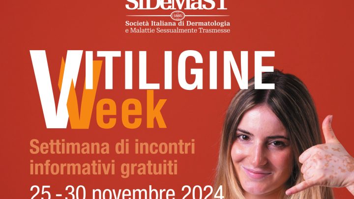 “Vitiligine Week”: visite gratuite anche in Campania
