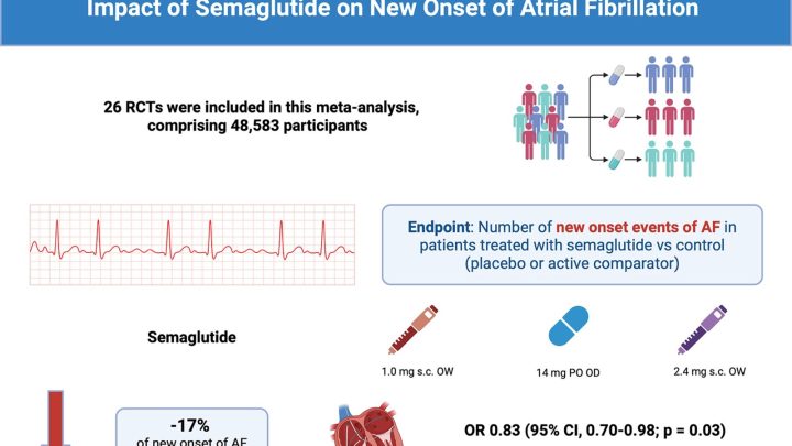 Fibrillazione atriale, un farmaco antidiabete potrebbe aiutare a combatterla