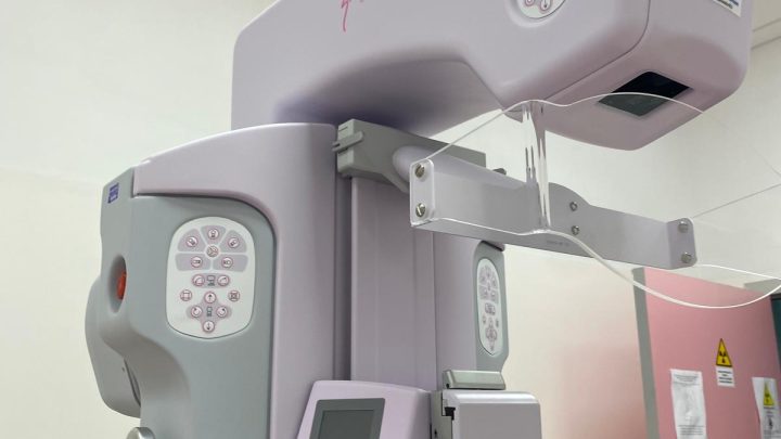 Prevenzione Asl Na 3, attivo screening mammografico a Torre del Greco